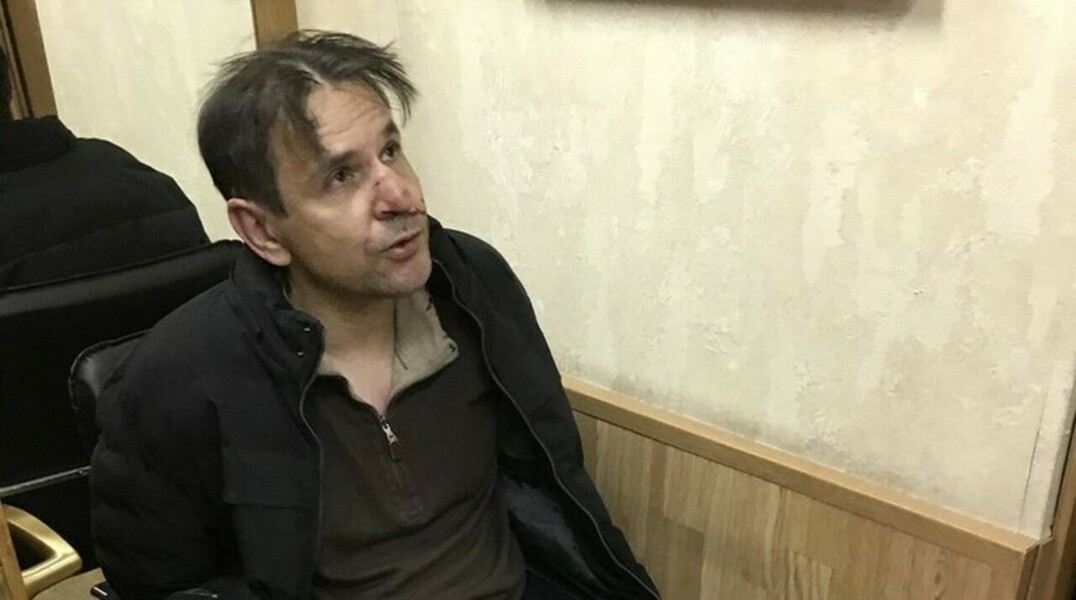 Ударивший ножом журналистку «Эха Москвы» подготовился к нападению — Daily Storm