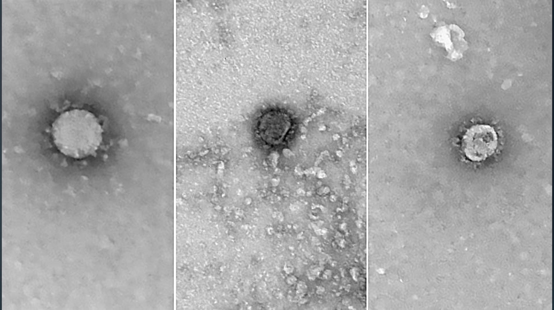 Dailystorm - Российские ученые показали фото коронавируса и расшифровали его полный геном