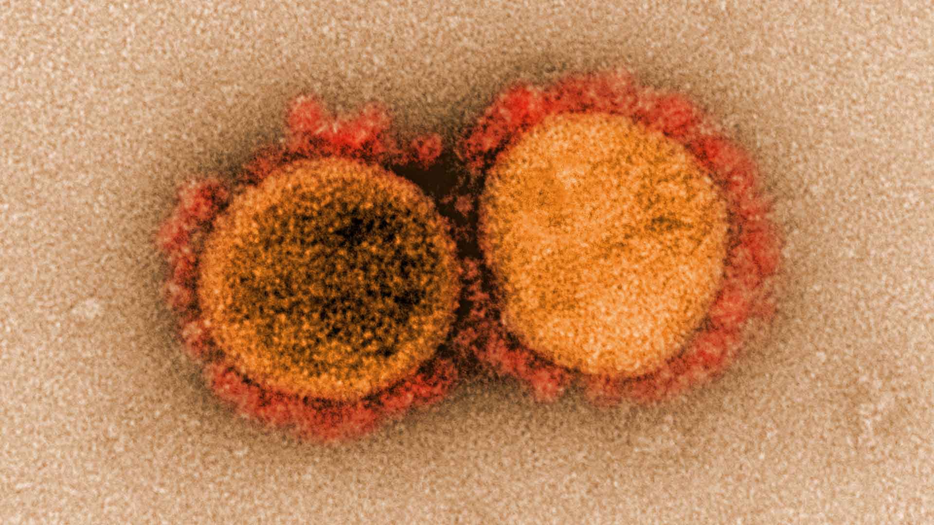 Dailystorm - Роспотребнадзор начал испытания вакцины против коронавируса