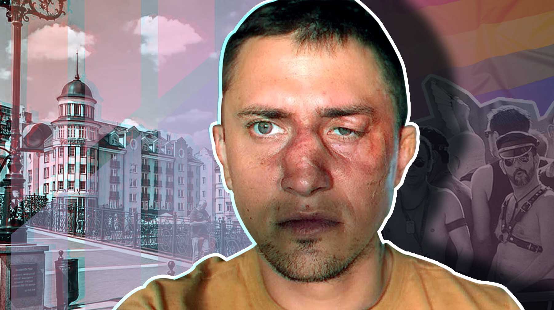Dailystorm - «Подрался за бабушку в гей-клубе»: Прилучный о драке в Калининграде