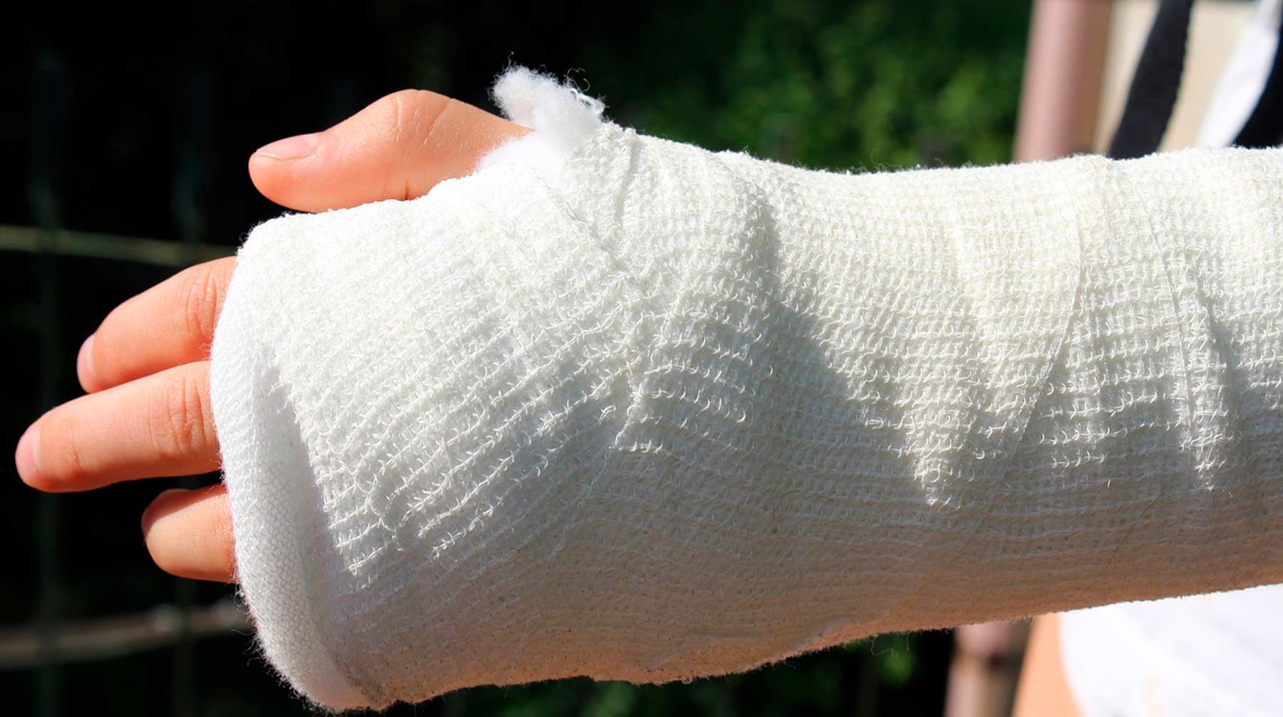 Из правой руки девочки нужно было извлечь спицы после перелома, но врач ошибся и сделал операцию на левой конечности Фото: © pixabay.com