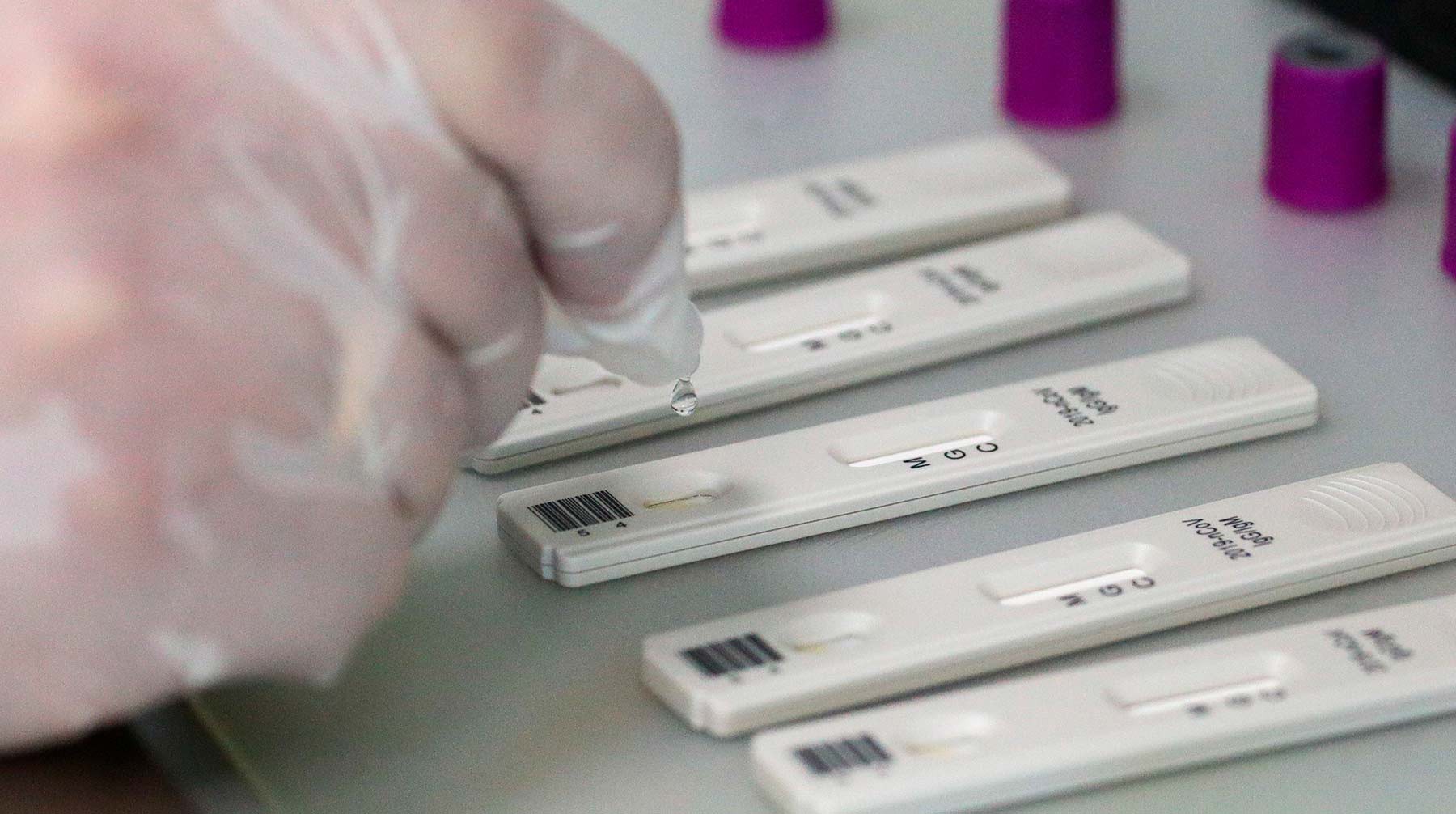 Dailystorm - Испытателям вакцины от коронавируса запретили сдавать тест на антитела