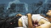 «Руки, спина, ноги — все было в глубоких рваных ранах»: история человека, выжившего после прилета и застрявшего в Сумах